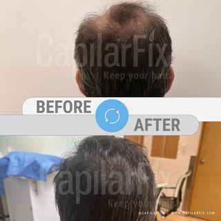 💬 “¡Pensé que nunca volvería a ver mi cabello crecer así!”

Con tratamientos innovadores y tecnolog