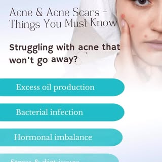 Acne is more than just skin deep! Understand the real reasons behind breakouts and take the right st