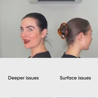 Surface/Deep issues! Anything is cured @draa.rthi 
~
Your clear skin is just one action away 🥰 
💬 