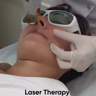 ACNE-scar problems? Say No more  with @draa.rthi 
.
Experience the difference:
🔹Result oriented tre