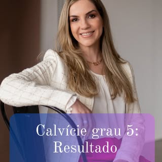 Um caso de calvície grau 5 como esse exige muito mais do que técnica. Exige planejamento, estratégia