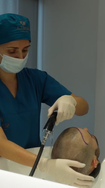 From preparation and hairline design to the procedure itself, our medical team is focused on deliver