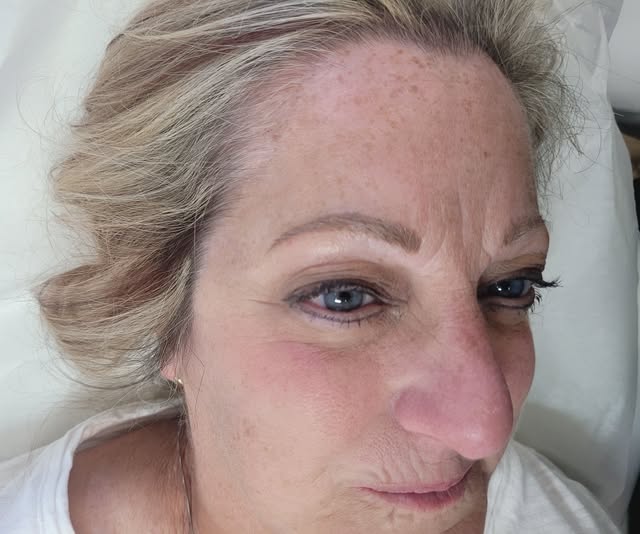 😲Beautiful blonde brows!❤️

#skincareroutine #allnaturalskincare #allnatural #Microneedling #PERWww