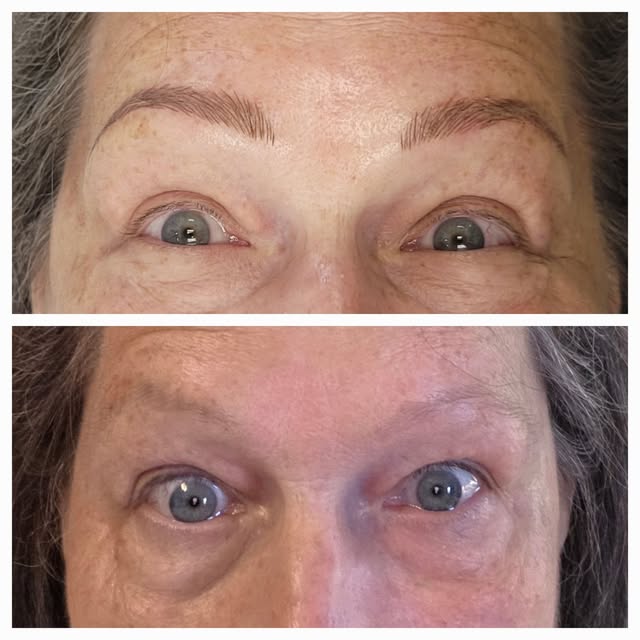 Before and after!
#skincareroutine #allnaturalskincare #allnatural #Microneedling #PERWww.permanentm