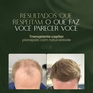 Antes e depois mostram o resultado.

Mas raramente mostram o que realmente fez ele acontecer.

Um tr