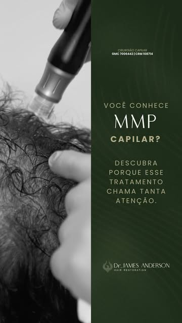 O MMP capilar (Microinfusão de Medicamentos na Pele) combina o microagulhamento com a aplicação de m