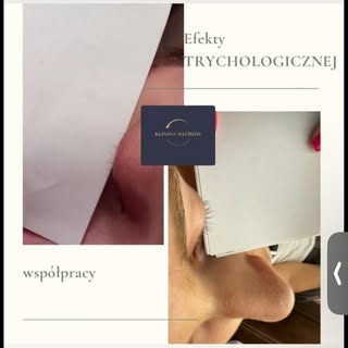 ✨ Z dumą dzielę się kolejnym sukcesem! ✨

Po 3 miesiącach wspólnej terapii udało się opanować nadmie
