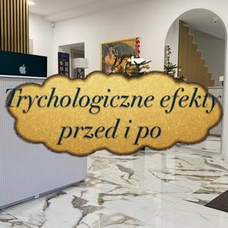 🫶ZAREZERWUJ SWOJĄ WIZYTĘ JUŻ TERAZ🫶
📍Grochowska 7a, Poznań 
📞667482777