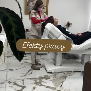 Odwiedź Klinikę Włosów i zobacz realne efekty pracy! 🚀
Twoje włosy, Twoja pewność siebie — zaczynam