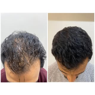 ✨ Transformations That Speak for Themselves! ✨

Swipe to see the magic of Revyve—where science meets