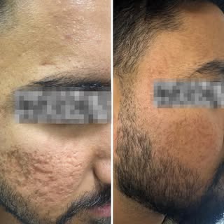 Real people. Real results.
At Revyve Care, transformations aren’t just visible — they’re confidence-