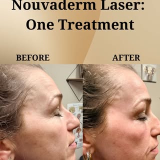 This is what happens when we treat skin at the source — not just the surface. At 716 Integrative Wel