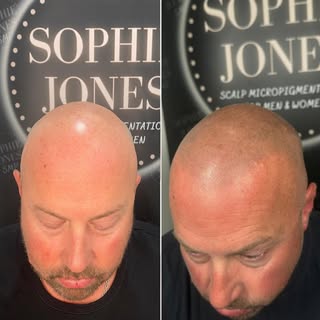 𝐒𝐩𝐞𝐚𝐤𝐬 𝐟𝐨𝐫 𝐢𝐭𝐬𝐞𝐥𝐟!📢
This before and after shows exactly how a subtle difference, can