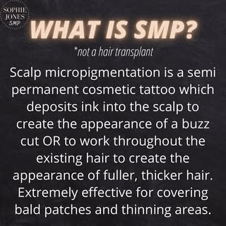 🗣 What is Scalp Micropigmentation? If you’re a 𝐦𝐚𝐧 𝐨𝐫 𝐰𝐨𝐦𝐚𝐧 suffering from hair thinning 