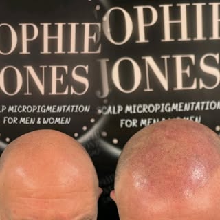 𝐒𝐄𝐒𝐒𝐈𝐎𝐍 𝟏
We are working slow and light to create a good foundation for our clients Scalp Mi