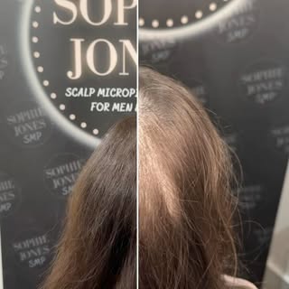 Healed session 1 VS before healed final session 🤩
Session 1 we mainly focused on the front of the s