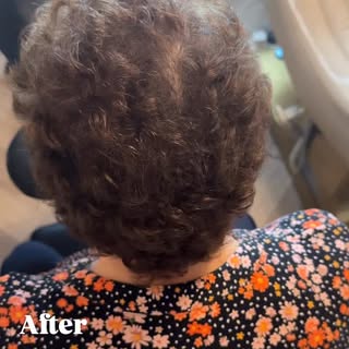 SMP isn’t just for men, it’s an incredible option for women experiencing thinning hair. Our goal is 