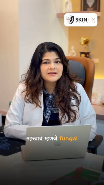 🍄 Fungal infection बरा झाल्यानंतरही pigmentation राहू शकते!

सर्वात आधी fungal infection पूर्णपणे ब