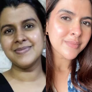 Real skin. Real features. Real transformation. ✨
No filters, no unrealistic promises—just the right 