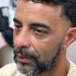 Quando o cabelo muda, a vida também pode mudar. ✨

A prótese capilar masculina vai muito além da apa