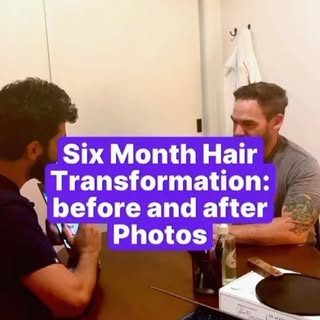 Hair Restoration 6mo Reaction video at Barber Surgeons Guild #hairtransformation #hairtransplant #ha