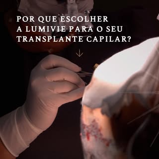 Na Lumivie, não oferecemos apenas um transplante capilar – oferecemos a garantia de um procedimento 