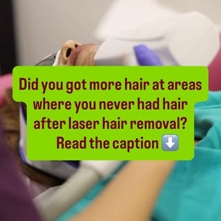 🚨 Your laser doctor may not be telling you about THIS.

You went for laser hair reduction… and sudd