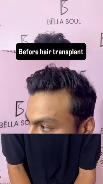 23 years old. One decision. A commitment to his hair for life. 🧑🏻‍🦱✨

Two years ago, he chose Neo