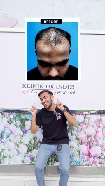 Tunggu... @rahmankayy Nak Tunjukkan Perubahan Ini! 🤯✨Daripada masalah rambut makin menipis di bahag