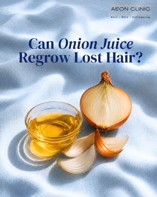 Can onion juice really bring lost hair back?

It's one of the most talked-about home remedies for ha
