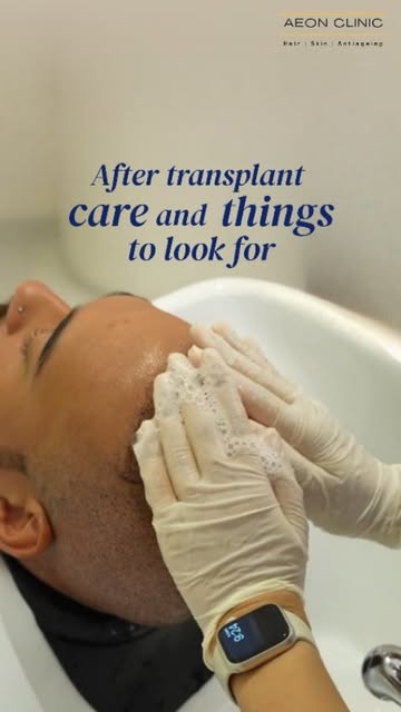 The transplant is done. Now the aftercare matters.

Good results start with good aftercare.

Book yo