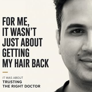 Hair Transplant Journey That Turned Out Perfect 

Hair loss can affect more than just your appearanc