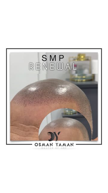 SMP Renewal ✔️

For detailed information and appointment;
📲 +90 (552) 570 32 08
📞 0(212) 270 00 08