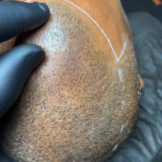 Work in progress, hairline drop. #SMP #smptrainingonline