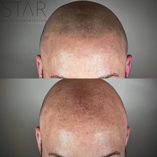 Take a close look at a Natural 1st session, stay tuned next week for session 2 results. Layering is 