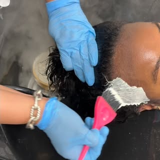 📍Client dealing with seborrheic dermatitis
🔬Before: Scalp analysis reveals buildup
& inflammation
