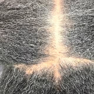 🚨 You can’t grow hair on a dead scalp.
These micro pics don’t lie. Before we could even think about