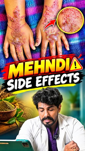 😲Mehndi side effects வராம Use பண்ணனுமா ? Simple ✅👍 இத Follow பண்ணுங்க  #mehndi #mehndiart #mehndin