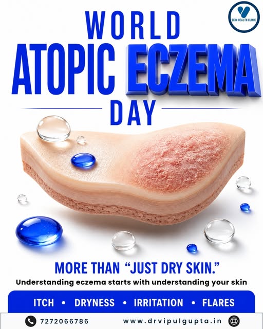 💙 Dry, itchy skin isn’t always “just dryness.” बार-बार होने वाली itching, irritation और flares Atop