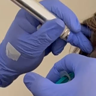 **Mesoterapia Capilar: Un Tratamiento Eficaz para la Caída del Cabello**

La mesoterapia capilar es 