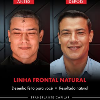 Cada traço pensado para o rosto desse paciente.

Isso não é um padrão que se repete em todos os caso