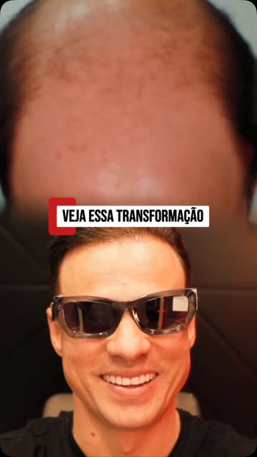 Ele entrou no consultório evitando espelhos. Saiu tirando selfie.

Aperta o play e entende o porquê.
