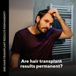 A common question from our patients: are hair transplant results permanent? Keep scrolling to find o