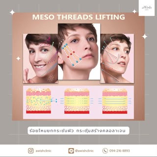 ขั้นตอนการทำโปรแกรม คือ❓
1. ปรึกษาคุณหมอถึงปัญหาบริเวณคาง
2. คุณหมอวิเคราะห์ใบหน้าและคางเบื้องต้น แล