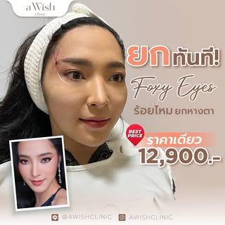 มาร่วมรังสรรค์ความงามอันเป็นตำนาน
เสกสร้างดวงตาที่โฉบเฉี่ยว สะกดทุกสายตา ที่นี่ที่เดียว อะวิช คลินิก