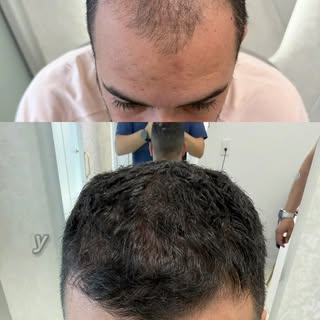 “Yo consideraba que los tratamientos de cabello no servían. Que era todo mentira”

Ese era Luis Migu