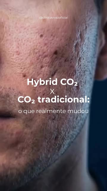Menos tempo parado, mais conforto e resultado igualmente poderoso.

Quer saber qual é o ideal pra vo