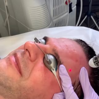 ✨ Introducing Framelift – The Future of Facial Aesthetics ✨

At Princeton Aesthetics, we are proud t