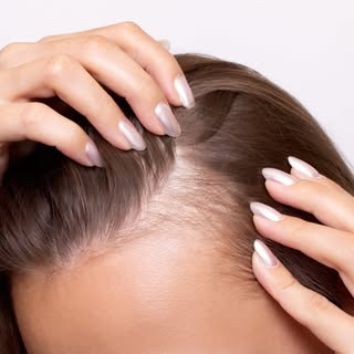 Say Goodbye to Hair Loss — The Future of Hair Regrowth is here at Princeton Aesthetics! 

Introducin