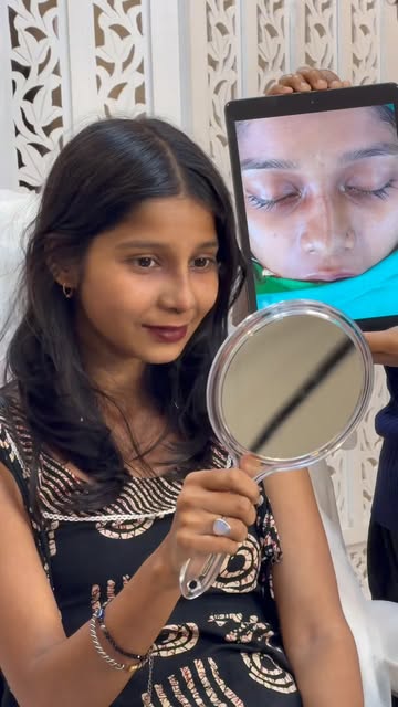 ✨ DAY 10 NOSE REVEAL | SEPTORHINOPLASTY 👃🏻

A beautiful Day 10 nose reveal for our lovely patient 